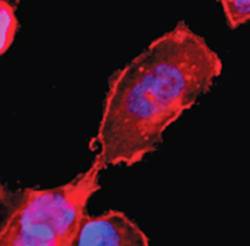 Mouse anti Human Sphingosine 1 Phosphate 4 Receptor (CT) (EDG6)