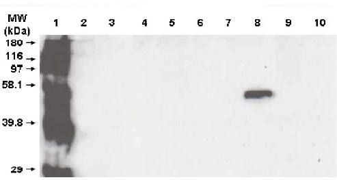 Mouse anti Human Cytochrome P450 3A5