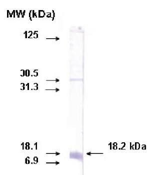 Mouse Human Cytochrome p450 26A1 Antibody