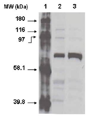 Cytochrome P450 4F11 antibody