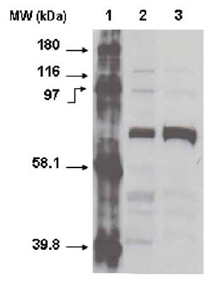 Mouse anti Human Cytochrome P450 4F11 Antibody