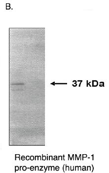 Mouse anti Human Matrix Metalloproteinase 1 (MMP1)