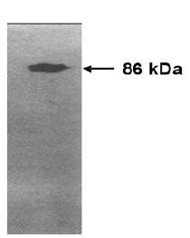 Mouse Human Matrix Metalloproteinase 9 (MMP9) Antibody