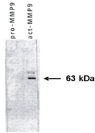 Mouse Human Matrix Metalloproteinase 9 (MMP9) Antibody