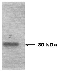 Mouse anti Human Tissue Inhibitor of Matrix Metalloproteinase 1 (TIMP-1)