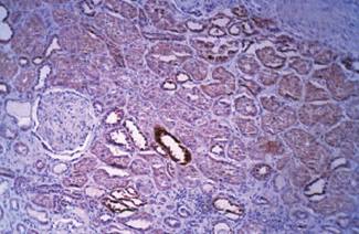 Rabbit Human Sphingomyelin Synthase 2 Antibody
