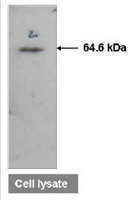 ATIC antibody