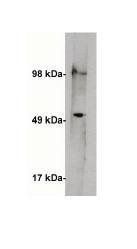 Rabbit Human Serine Palmitoyltransferase 1 Antibody