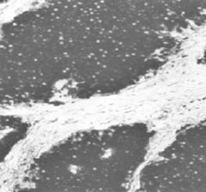 Neuron-Specific Enolase antibody