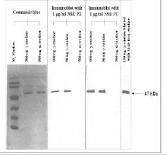 Neuron-Specific Enolase antibody