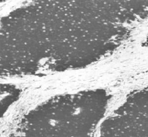 Neuron-Specific Enolase antibody