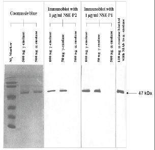 Neuron-Specific Enolase antibody