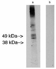 Rabbit Human Lass2 Antibody