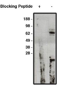 Rabbit Human NUMB Antibody