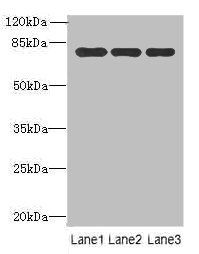 Xaa-Pro aminopeptidase 1 antibody