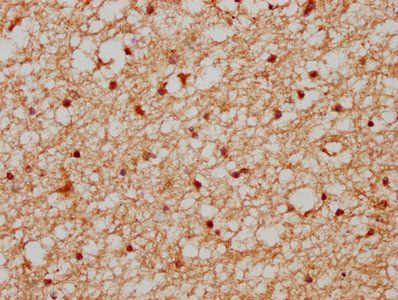XAB2 Antibody