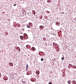 Goat anti-XAB2 / HCNP Antibody