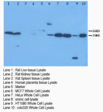 Anti-XIAP-associated factor 1 XAF1 Antibody