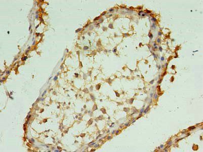 XAGE1A Antibody