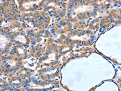 XBP1 Antibody