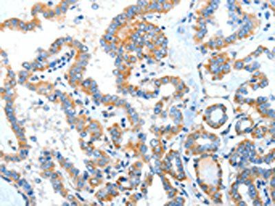 XBP1 Antibody