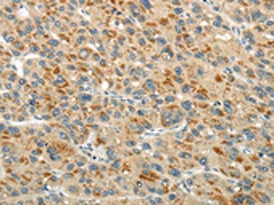 XK Antibody