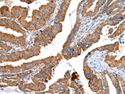 XKR4 Antibody
