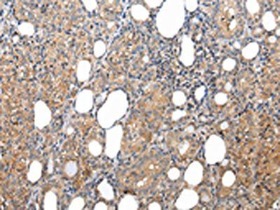 XKRX Antibody