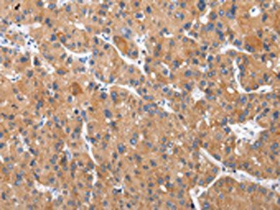 XKRX Antibody