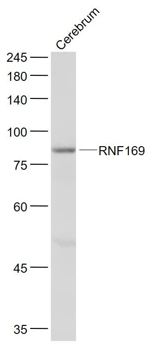 RNF169 antibody