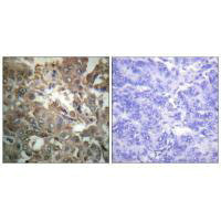 XPA antibody