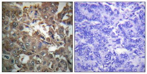 XPA Antibody