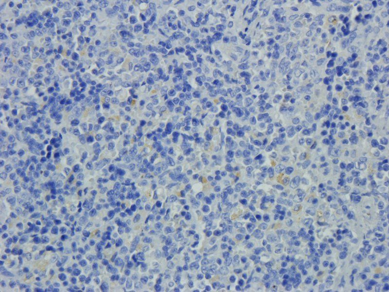 XPNPEP2 antibody