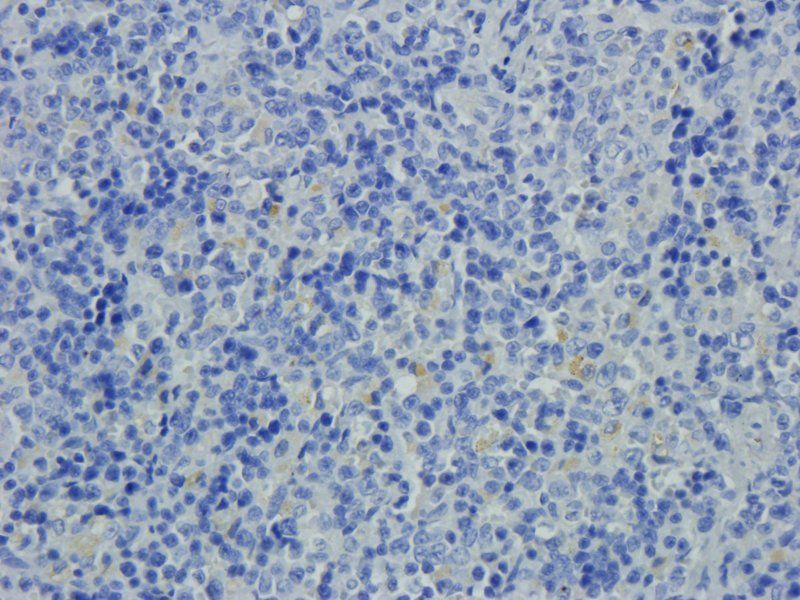 XPNPEP2 antibody