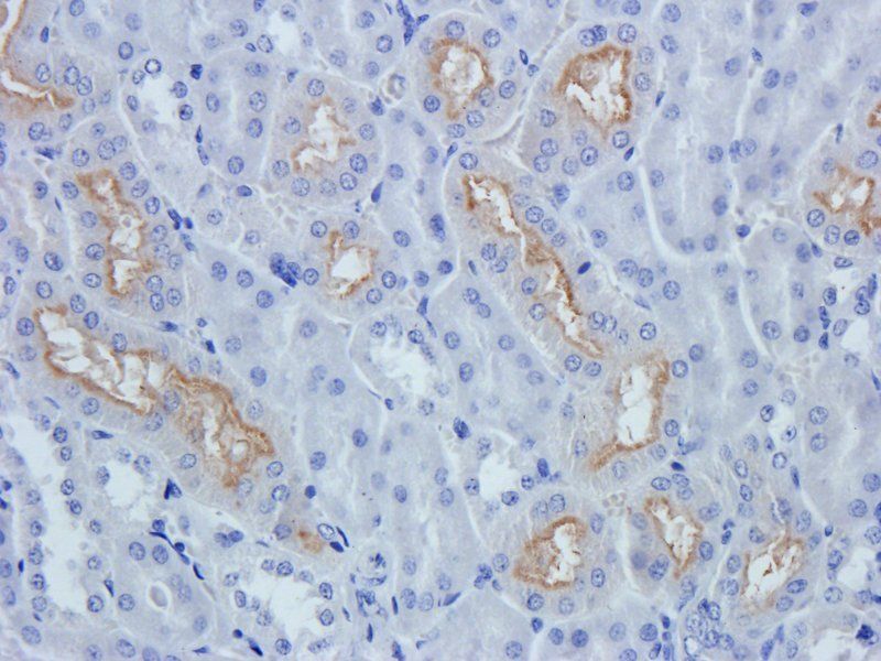 XPNPEP2 antibody