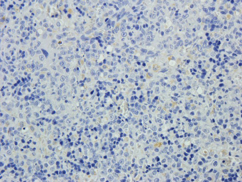 XPNPEP2 antibody