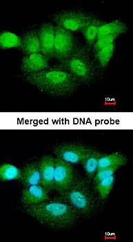 XPNPEP3 antibody