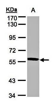 XPNPEP3 Rabbit Polyclonal Antibody