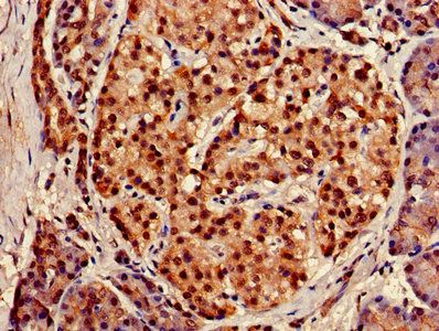 XPO1 Antibody