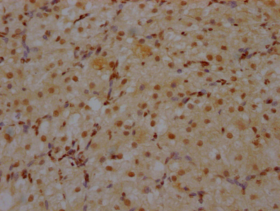 XPO1 Recombinant Monoclonal Antibody