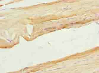 XPR1 Antibody
