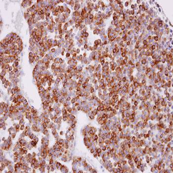 XPR1 antibody