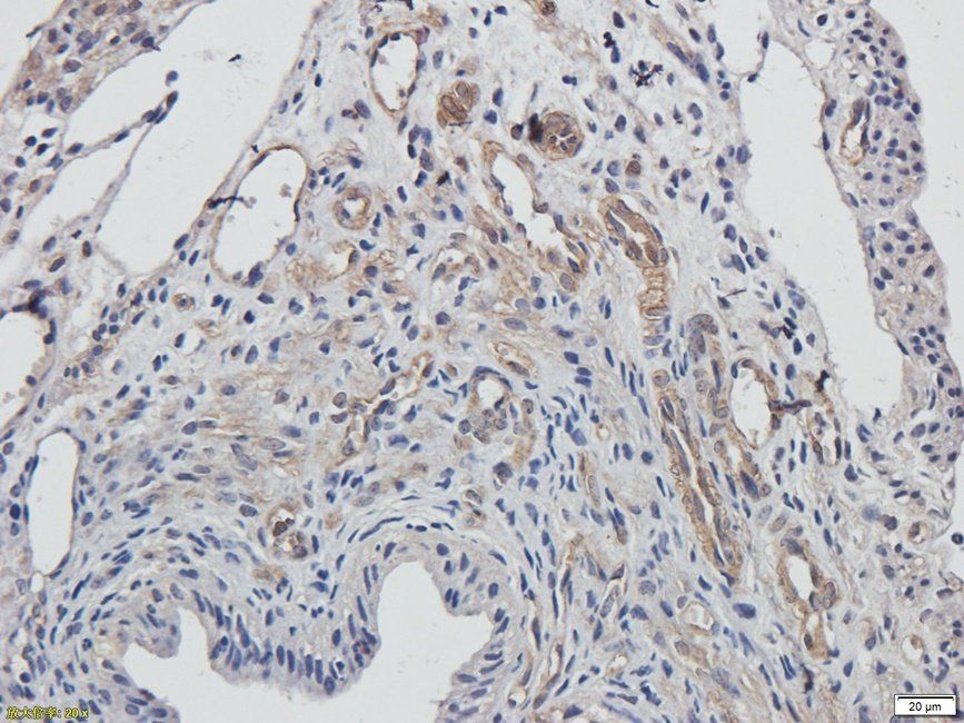 XRCC1 antibody