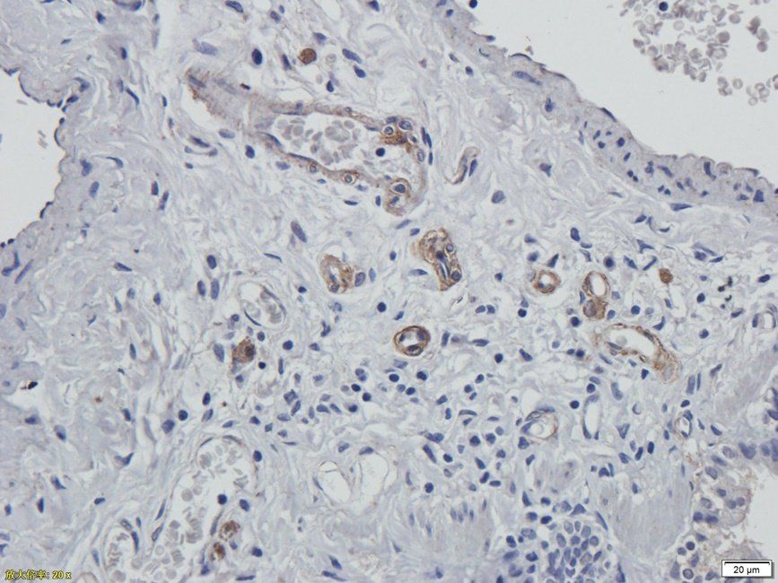 XRCC1 antibody