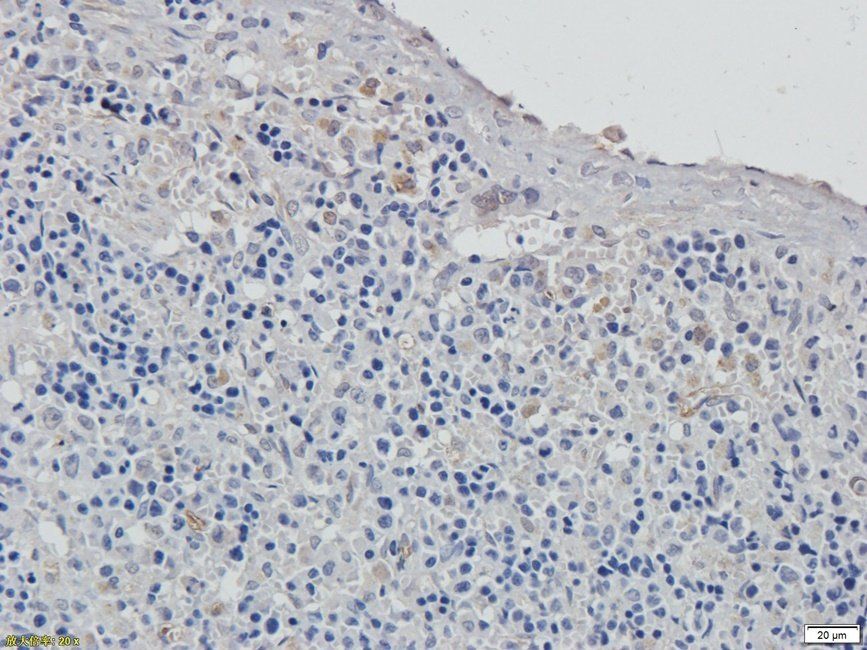 XRCC1 antibody