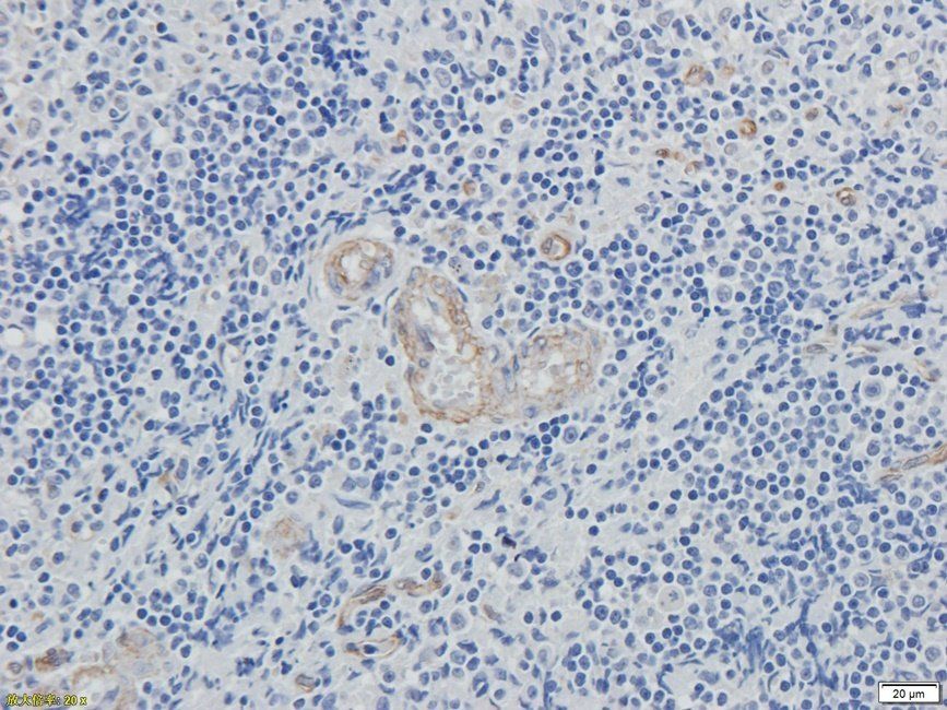 XRCC1 antibody