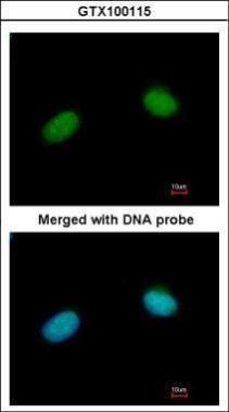 XRCC3 Rabbit Polyclonal Antibody