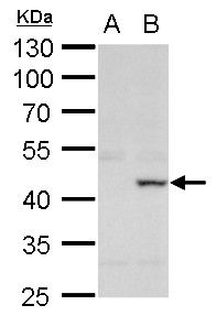 XRCC3 Rabbit Polyclonal Antibody