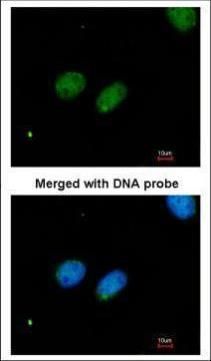 X-ray repair cross complementing 4 Antibody