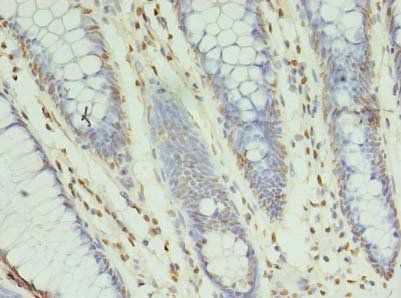 XRCC5 Antibody